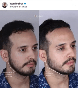 Harmonização Facil